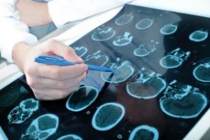 Curso Gratuito Online com Certificado - Introdução à Neuropsicologia